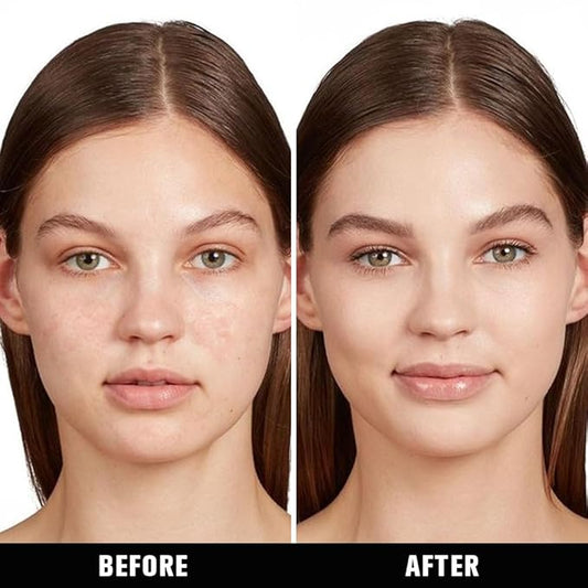 Kaely Liquid Concealer for Older Women, Under Eye Brightener Full Coverage Concealer for Dark Circles, Color Correcting Foundation Face Makeup Waterproof, Vegan & Cruelty-Free, 04 Medium Beige