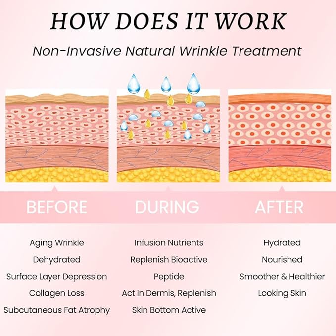 Kaely Wrinkle Patches for Face Overnight, Silicone Scar Tape for Wrinkles Forehead, Smile Line, Face Tape for Wrinkles Overnight Sleeping Lifting Sagging Skin, 128 Pcs (8 Sheets of 16 Patches)