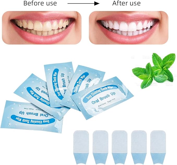 100 PCS Deep Cleaning Finger Toothbrush Teeth Cleaning Whitening Wipes for Oral Brush Ups Mint Flavor