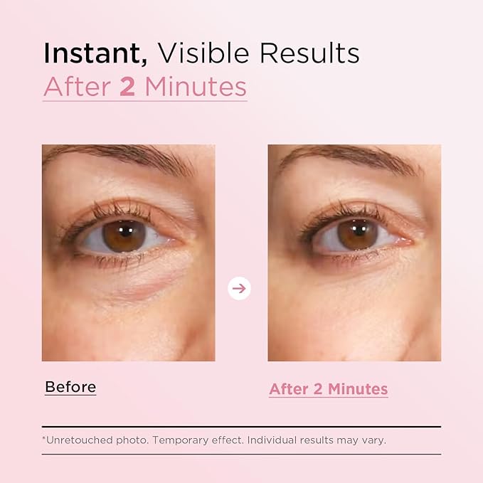 VELAMO ADVANCED Instant Eye & Face Lift Cream: Rapid Under Eye Bags Wrinkles Smile Lines Forehead Lines Remover - Temporary Firming & Tightening Treatment in 2 Minutes 1 OZ/30g