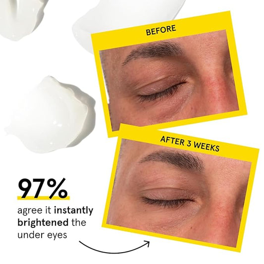 Lumin Men’s Dark Circle Defense Balm – Hydrating Eye Cream with Caffeine & Niacinamide, Korean Skincare for Men, Reduces the Look of Puffiness, Fine Lines & Dark Circles, Daily & Night Use, 20ml