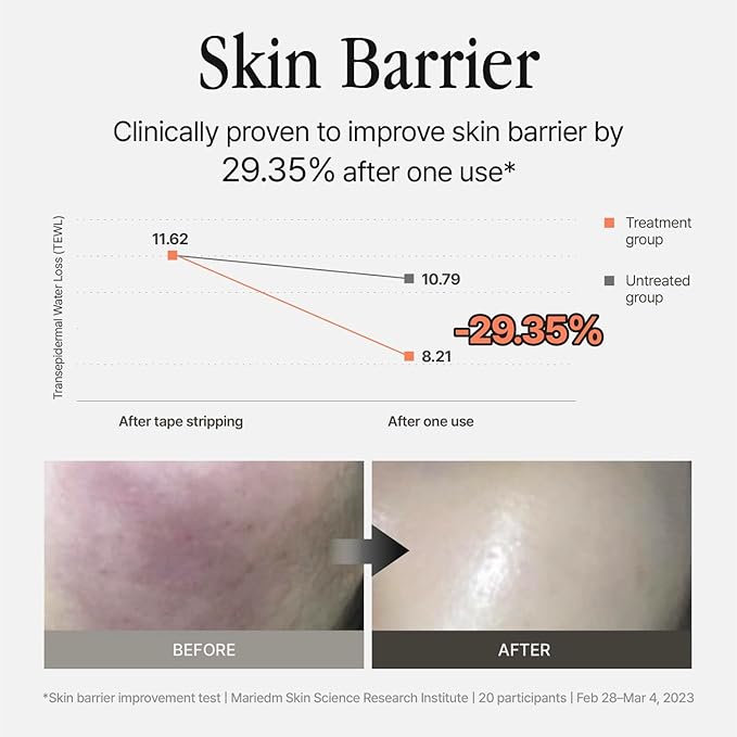 Silver Shield Mist - Facial Barrier Toner Spray, 80% Witch Hazel Water, Centella Asiatica for Skin Barrier Repair, Recovery Calming Mist for Sensitive Skin, Korean Skin Care (3.38 fl oz)