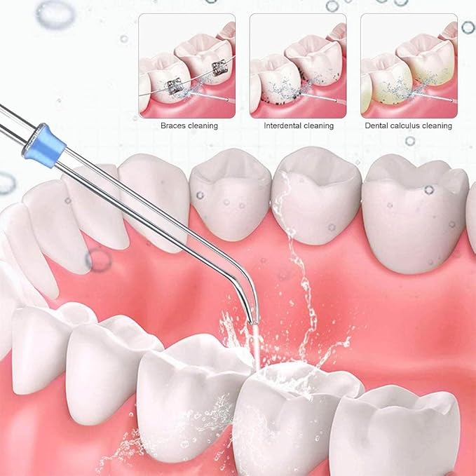 4 Pcs Replacement Tips For Waterpik Water Flosser,Replacement Heads for Waterpik Water Flossers Other Brand Oral Irrigators,Replacement Classic Jet Tips(Black,Blue,Purple,Green).