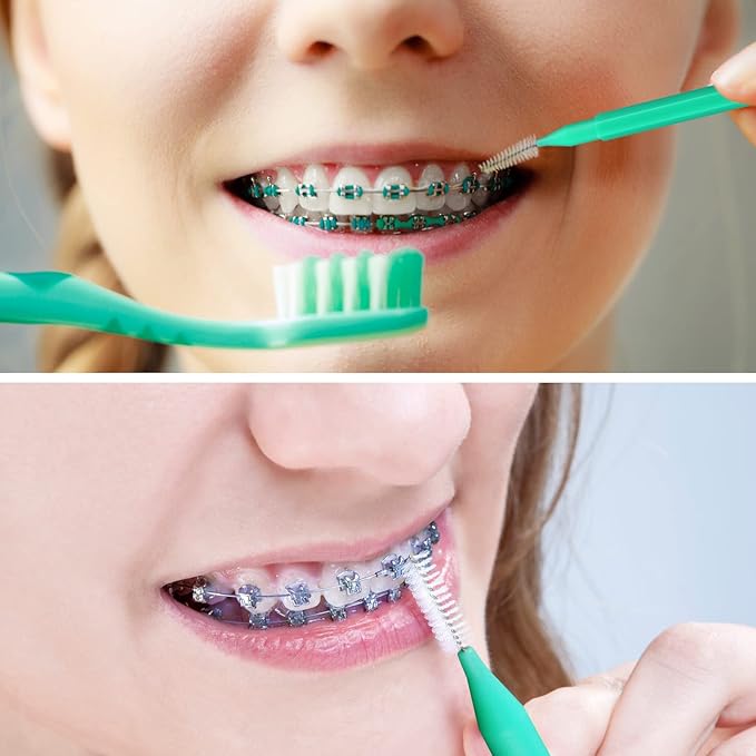 Interdental Brush, 60Pcs Soft Braces Brush Set, 20Pcs Tooth Flossing Head for Oral Hygiene Tooth Cleaning with 40pcs Disposable Braces Flossers Tooth Cleaning Tool (Stylish Colors,Multiple Sizes)