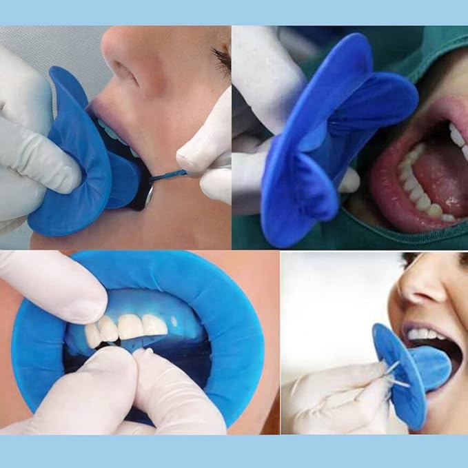 5 Pcs Dental Dam Cheek Retractor, Disposable Sterile Mouth Opener Lip Protector for Teeth Repair & Whitening, Orthodontics (Blue)