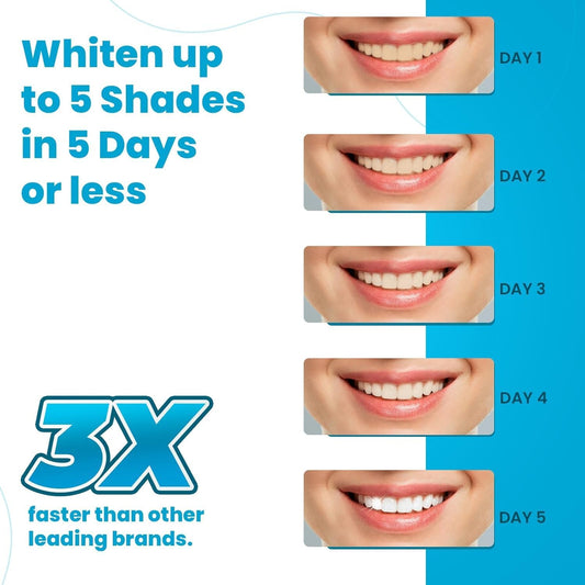 Advanced Teeth Whitening Strips – Pack of 10 (5 Treatments) - 5 Shades Brighter in 5 Days - Mint Flavored with Enamel Safe Comfort Fit Technology - Teeth Whitening Kit for Sensitive Teeth