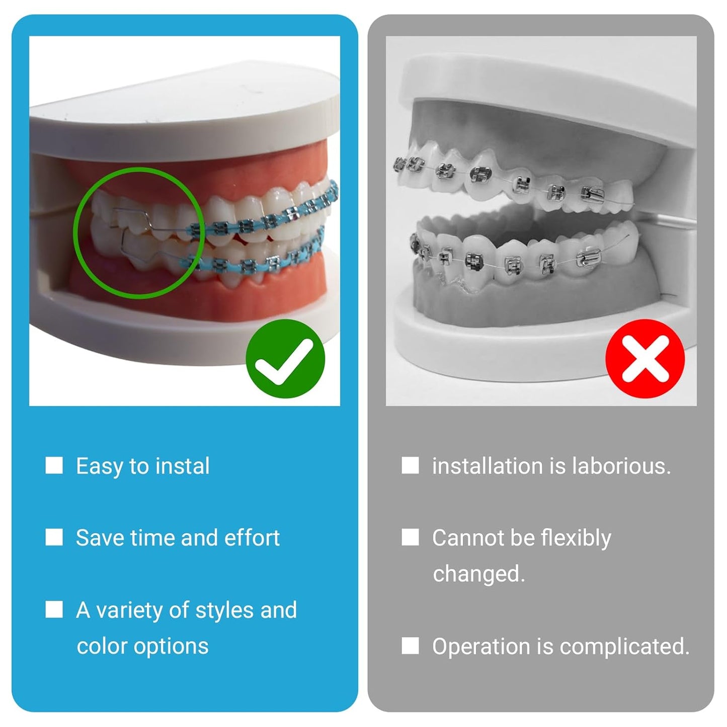 4 Pair of Temporary Tooth Decoration, Teeth Retainer Practical Brackets para Dientes Sturdy Retenedores de Dientes Ortodoncia Props for Dental Students to Practice (Blue)