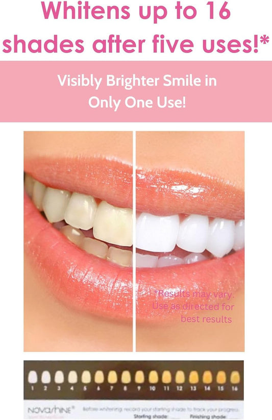 Novashine Professional Teeth Whitening Kit: Advanced Blue LED Light, Concentrated Peroxide Gel, Smartphone Adapter, Travel Bag