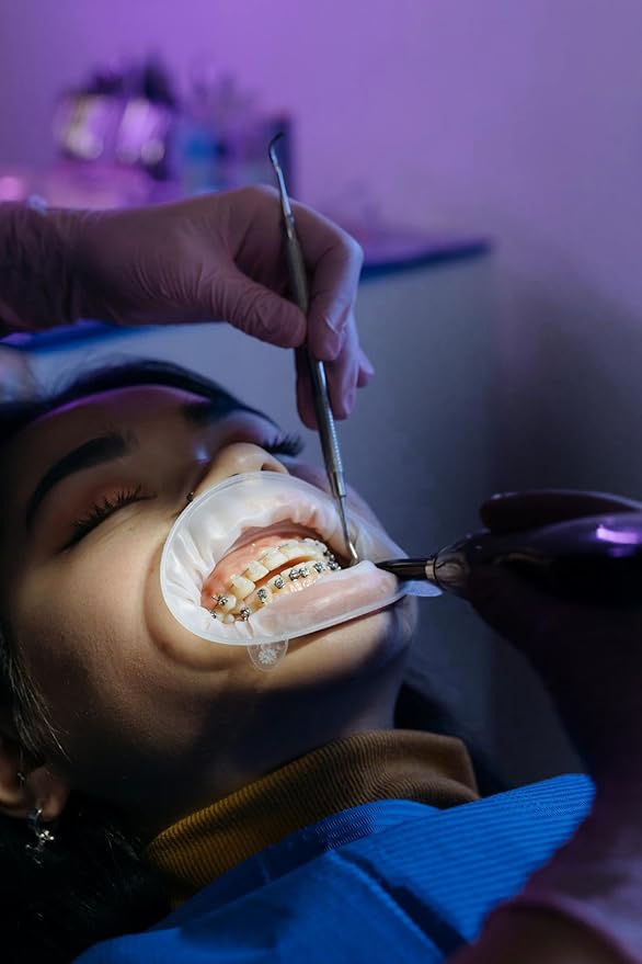 Tooth Polisher,Teeth whitening kit 12 Pieces Accessories，Teeth Polishing Kit for Daily Cleaning,Polishing Then Whitening kit