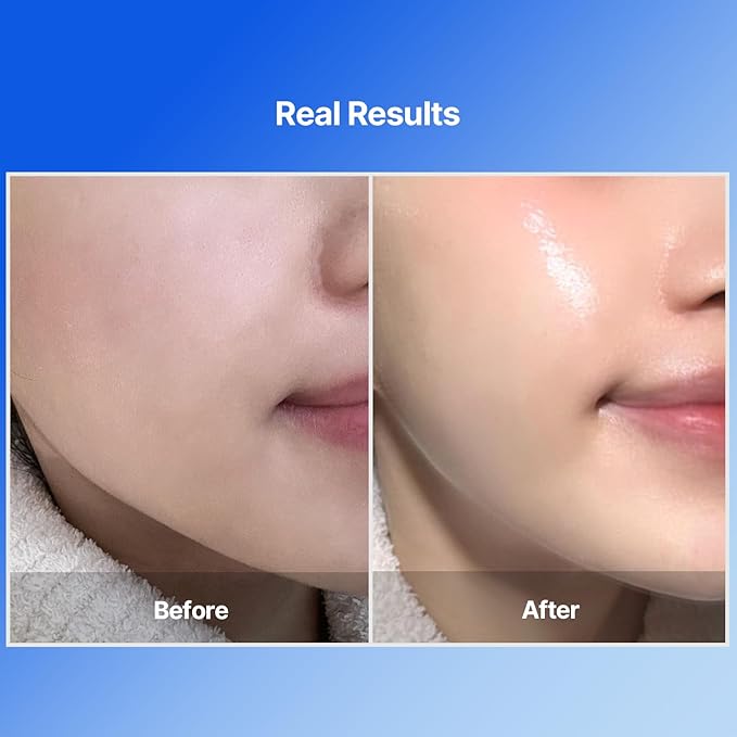 Bluelayer Water Dome Mask - Korean Overnight Collagen Face Mask for Glass Skin, Moisturizing and Firming with Hyaluronic Acid & Blue Agave - Pore Minimizing with Hydrogel Masks for Radiant Glow - 4EA