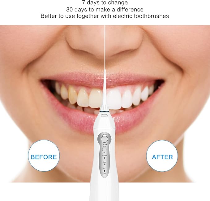 TOVENDOR Electric Water Flosser, Cordless Rechargeable Dental Oral Irrigator IPX7 Waterproof 300ML Travel Water Teeth Cleaner with 5 Tips for Braces Care Teeth Gums Cleaning, Home Office Daily Use