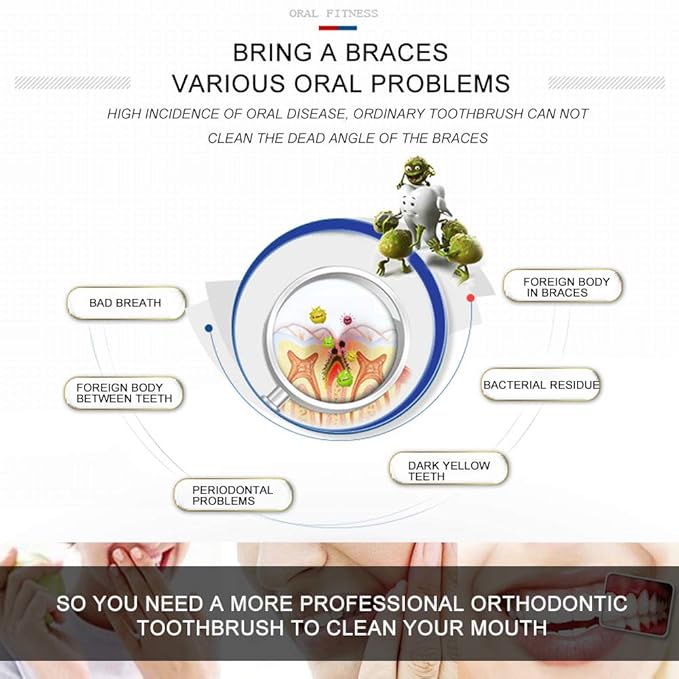 Angzhili 9-Piece Interspace Toothbrush Set - Tapered Orthodontic Brushes for Hard-to-Reach Areas, Gap Toothbrush for Braces, Bridges & Implants