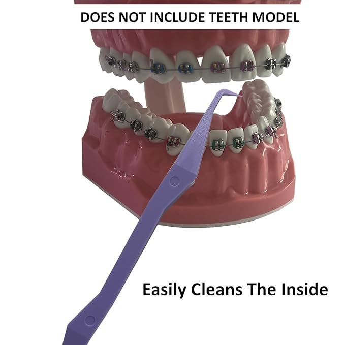 Keyfit Tools PerfectPick For Braces Flosser Pick Gum Line Scrapper Gets Between Teeth Along The Gum Line & Behind Braces Removes Plaque Non Metallic ABS Dental Tool