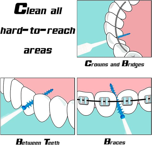 Soft Silicone Interdental Brush, Braces Brush, Corrective Brush, Adaptive, Disposable Picks for Teeth Cleaning (100PCS)