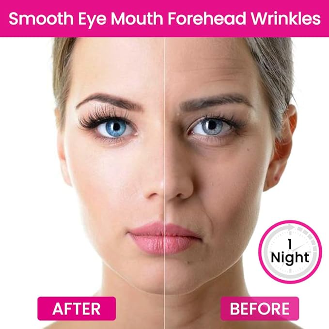 Kaely Wrinkle Patches for Face Overnight, Silicone Scar Tape for Wrinkles Forehead, Smile Line, Face Tape for Wrinkles Overnight Sleeping Lifting Sagging Skin, 256 Pcs (16 Sheets of 16 Patches)