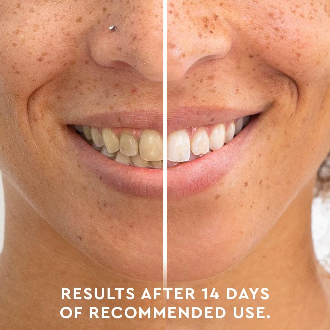 MOON Teeth Whitening Pen - Gentle on Sensitive Teeth, Whitens with Antioxidants & Essential Oils - Vegan Whitening Gel in an Easy Applicator - Vanilla Mint