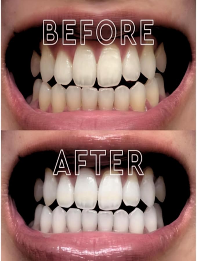 Purple Toothpaste Teeth Whitening Gel – Color Corrector Toothpaste for Yellow Teeth Removal – Peroxide-Free, Gentle Whitening Serum for Sensitive Teeth & Fresh Breath – 30ml by ITZZO