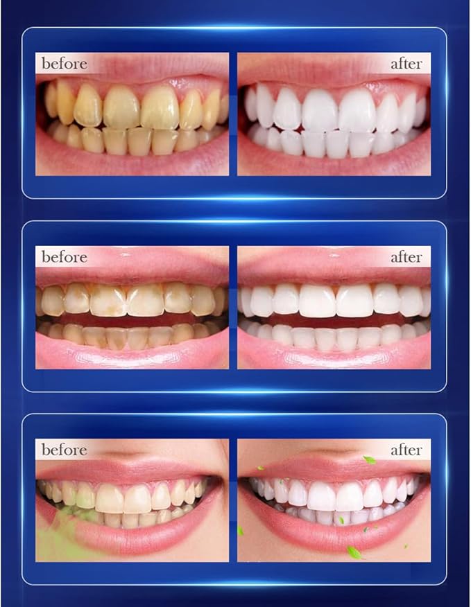 Press Toothpaste,Baking Soda Whitening Toothpaste,Stain Removal Whitening Strong Cleaning Power Natural Stain Remover Fluoride-Free (310 g)