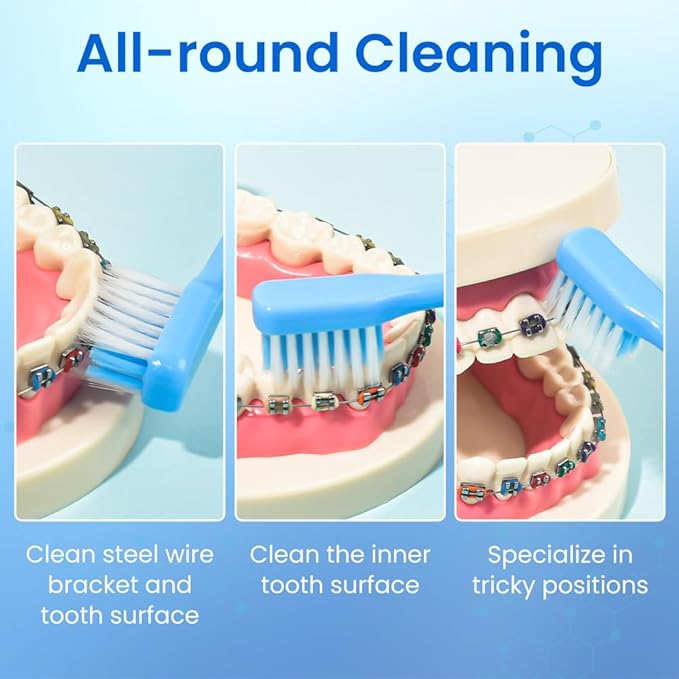 Y-Kelin V-Shaped Orthodontic Toothbrush for Braces Brackets 4 Count (Pack of 1) Soft Bristle with Inter Dental Brush