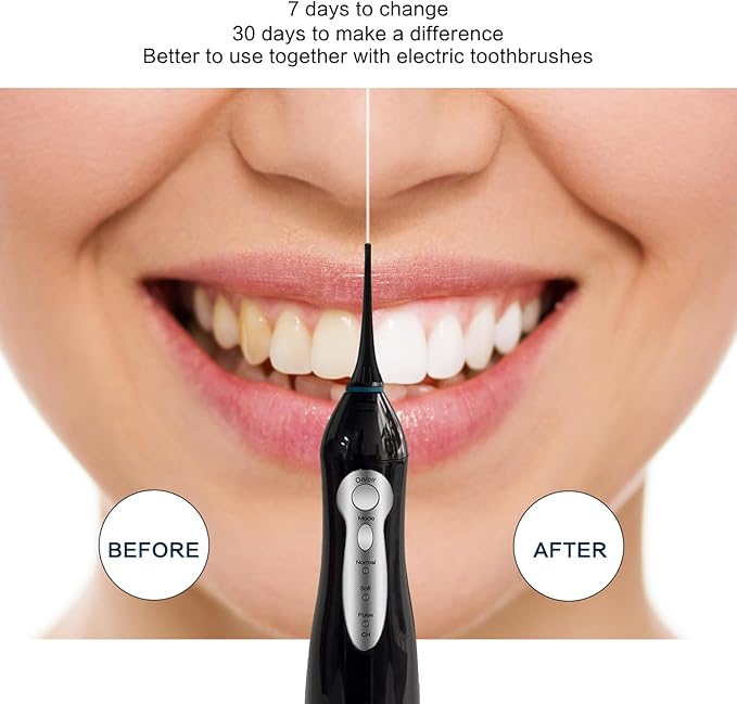 TOVENDOR Electric Water Flosser, Rechargeable Dental Oral Irrigator - 3 Modes, 5 Tips for Teeth, Gums, Braces, Dental Care, Family Oral Health (300ML, IPX7Waterproof Waterflosser)