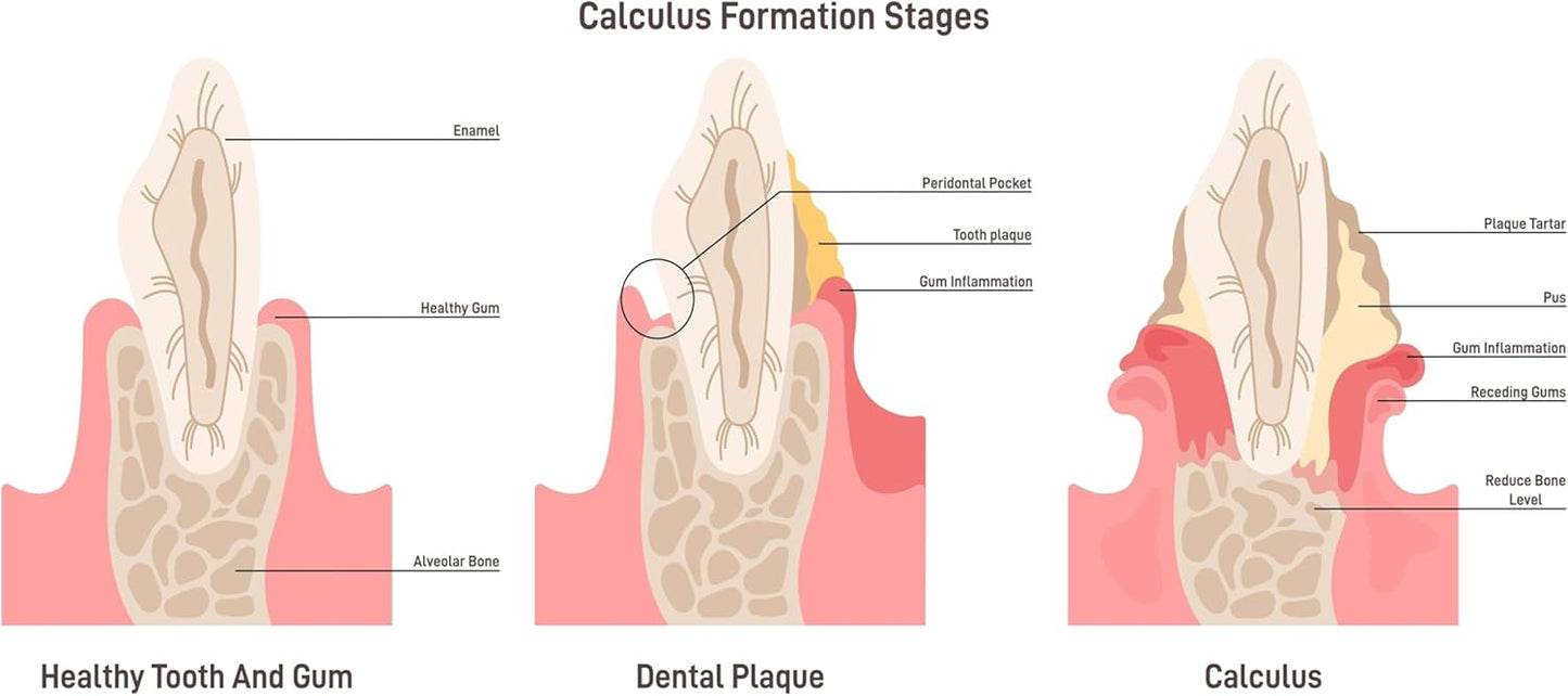 Cocorange Brite Anti-Plaque and Anti-Tartar Teeth Cleaner - Remove Plaque in Days and Tartar Removal from Home (Additional Honey, 2 fl oz)