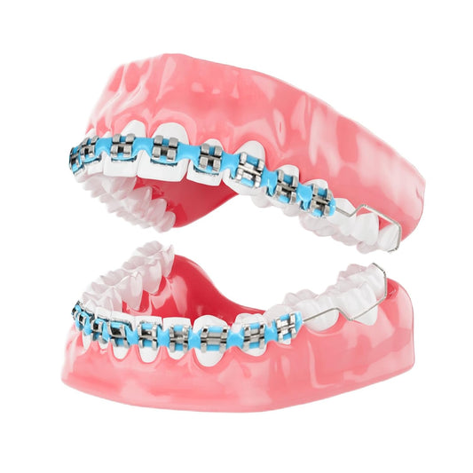 4 Pair of Temporary Tooth Decoration, Teeth Retainer Practical Brackets para Dientes Sturdy Retenedores de Dientes Ortodoncia Props for Dental Students to Practice (Blue)