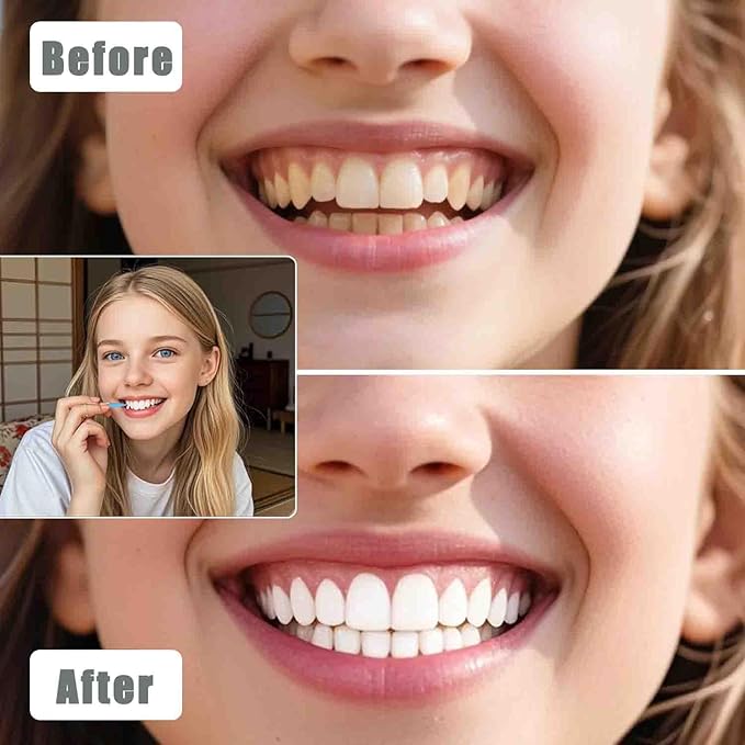 100pcs Interdental Brushes Dental Cleaning Tools Tooth Floss Picks Oral Hygiene Toothpicks