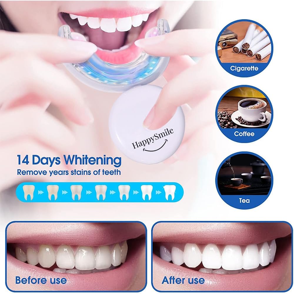 HappySmile LED & Pen Teeth Whitening Kit - Professional Oral Care for White Teeth - Includes Teeth Whitening Pen & LED for a Brighten Your Smile - Premium Teeth Whitening kit