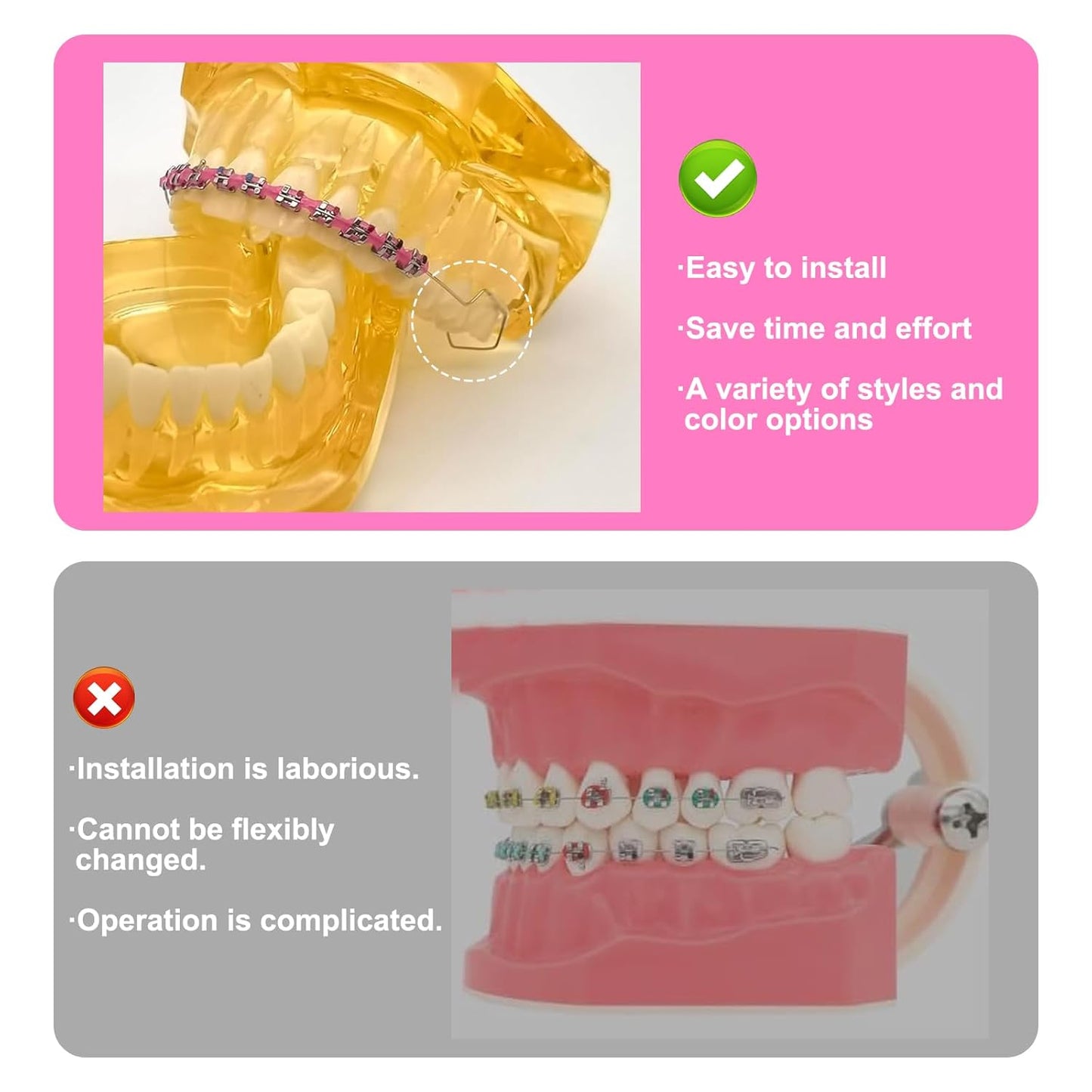 4 Pair of Temporary Tooth Decoration, Teeth Retainer Practical Brackets para Dientes Sturdy Retenedores de Dientes Ortodoncia Props for Dental Students to Practice (Pink)