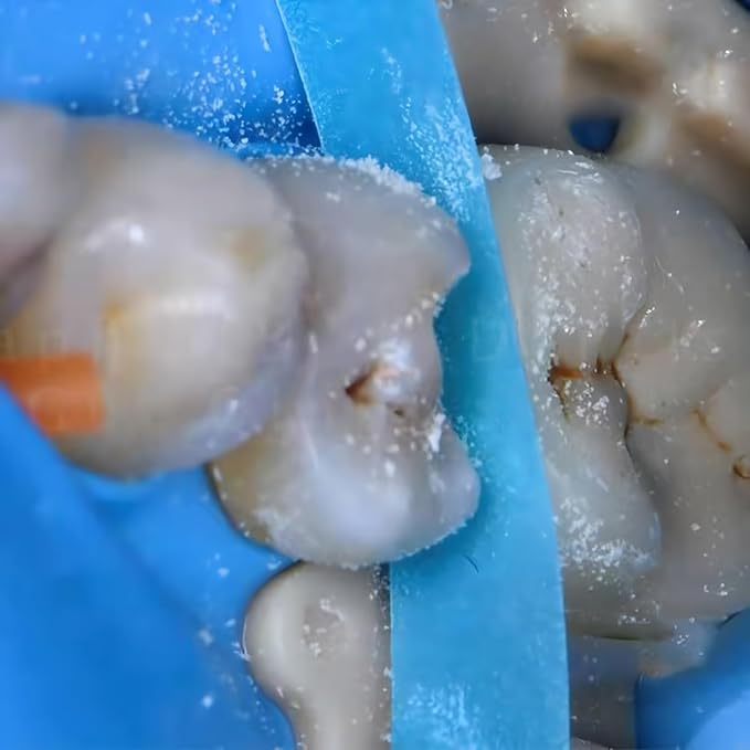 2Box Dental Polishing Strips, 4mm Tooth Interdental Resin Surface Sanding, Teeth Whitening Oral Care, Dental File for Teeth, Dentist Tools