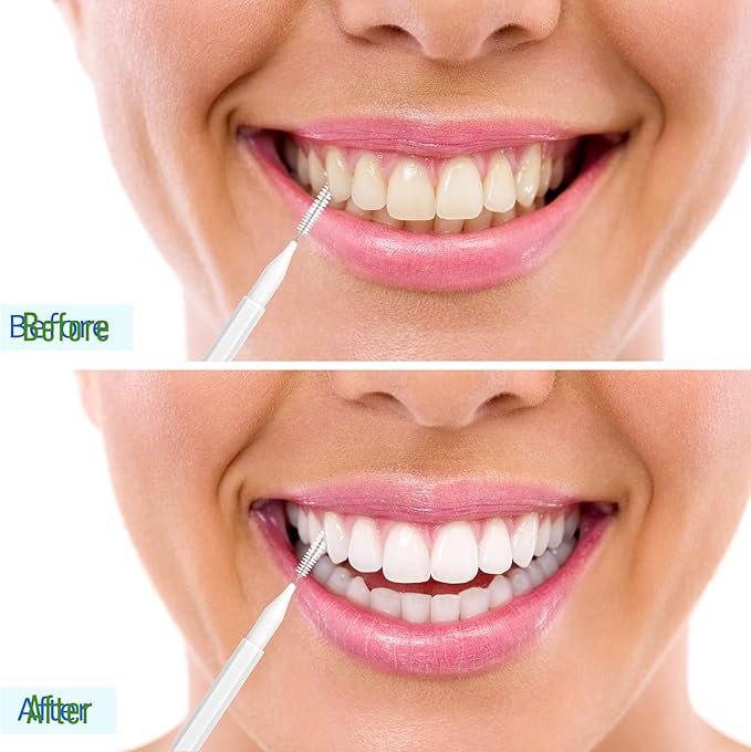 Patelai 50 Pieces Interdental Brush for Cleaner Braces Brush Toothpick Dental Tooth Flossing Head Oral Dental Hygiene Flosser Toothpick Cleaners Tooth Cleaning Tool(White)