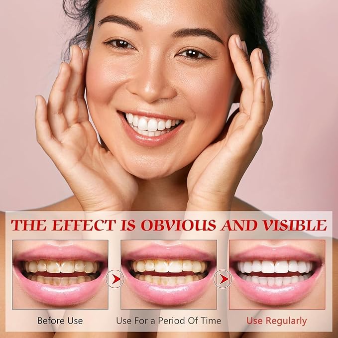 SP-6 Probiotic Whitening Fluoride Free Toothpaste, Upgraded Formula | Ultra Brightening | Gums & Enamel Repair | Mint Flavor | Dental Fresh | Removes Stain & Plaque | Sensitive Teeth Protection