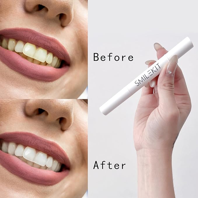 Portable Teeth Whitening Pen (2 Count) - Easily Removes Stains, Effective, Painless, Non-Irritating, and Travel-Friendly.