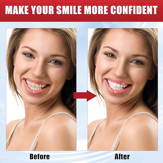 2Pcs Super ProbioticSp-8 Toothpaste, Sp 8 Pasta Dental, SP-8 Toothpaste, Pasta Dental Sp-8,SP8 Probiotic Toothpaste, Deep Cleaning Care Toothpaste