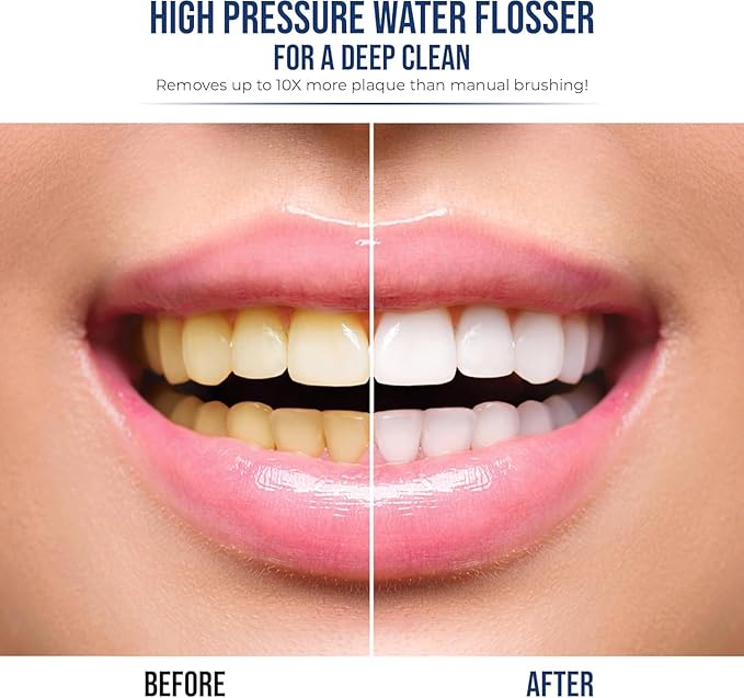 Flossing Toothbrush 2-in-1 Electric Toothbrush Water Flosser Combo – Sonic Toothbrush with 40k Vibrations & High Pressure Dental Flosser, 5 Brushing Modes, Ideal for Braces & Implants