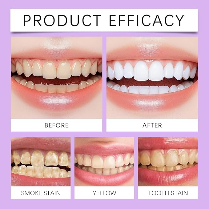 2025 New Whitening Purple Toothpaste,3X White Brilliance Toothpaste, Fluoride-Free Teeth Whitening,Tooth Stain Removal Colour Corrector (2)