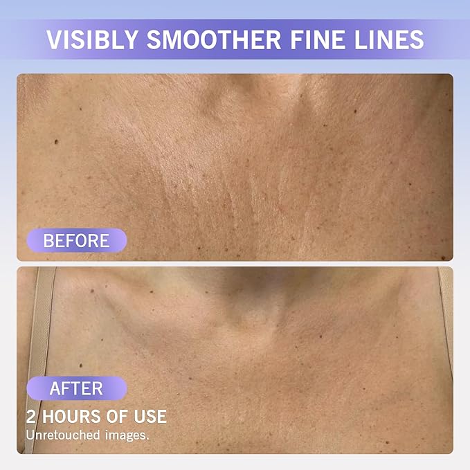 Forehead Wrinkle Patches – Anti Wrinkle Silicone Pads for Fine Line Remover, Reusable Face, Neck & Chest Decollete Patches for Women, Overnight Anti Aging Wrinkles Patches for Sensitive Skin, 6 Pack