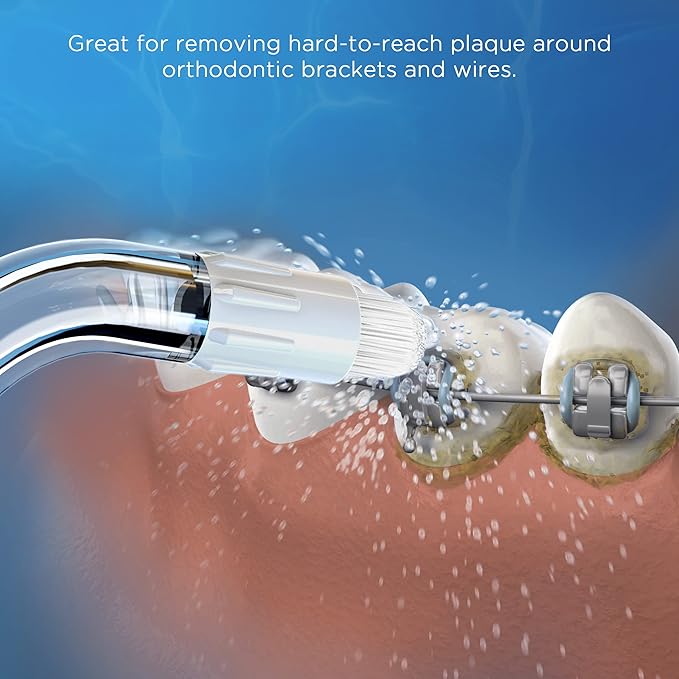 Replacement Tips for Waterpik Water Flosser (2 Classic Jet Tips + 2 Orthodontic Tips + 2 Plaque Chaser Tips+ Storage Case Combo)