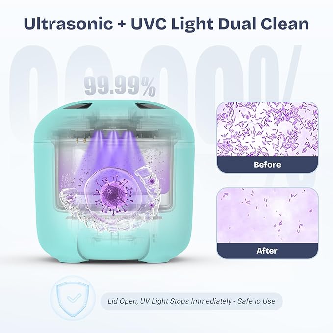 2025 Ultrasonic Retainer Cleaner- 45KHz 25W Portable Denture Cleaner with Drying Function and Removable Inner for Dentures, Mouth Guards, Aligners, Jewelry and More (Blue)