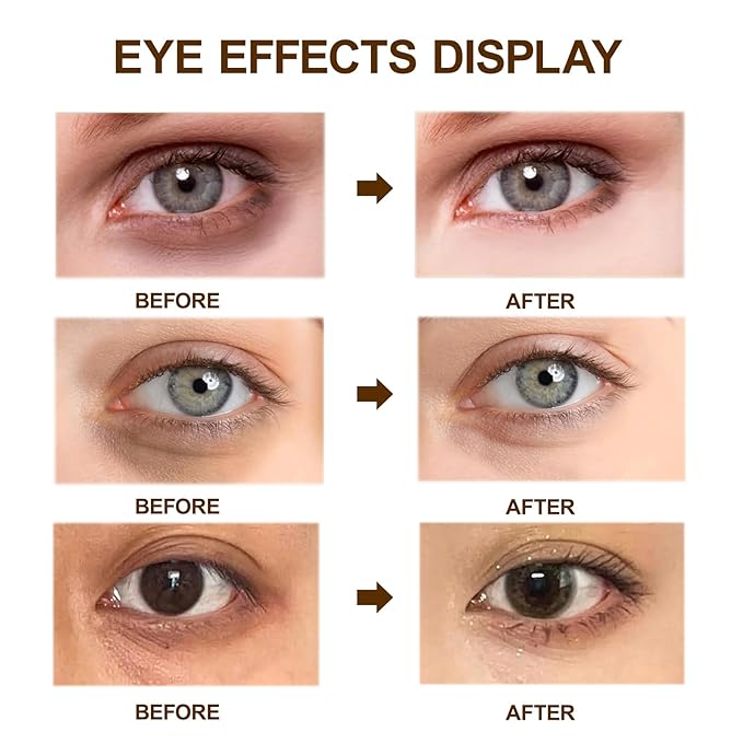 Caffeine Eye Cream for Dark Circles,Under Eye Cream for Puffiness and Bags,Eye Cream Anti Aging for Men Women Reduce Wrinkles Fine Lines, Suitable for All Skin Types 0.5 fl.oz