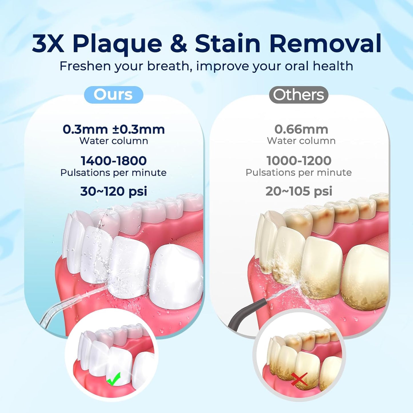 Portable Travel Water Flosser for Teeth – FOMIS Mini Water Flosser with 5 Mode, 5 Nozzles, 180ML Collapsible Tank, Smart Timer, IPX7 Waterproof Cordless Oral Irrigator for Brace & Sensitive (Black)