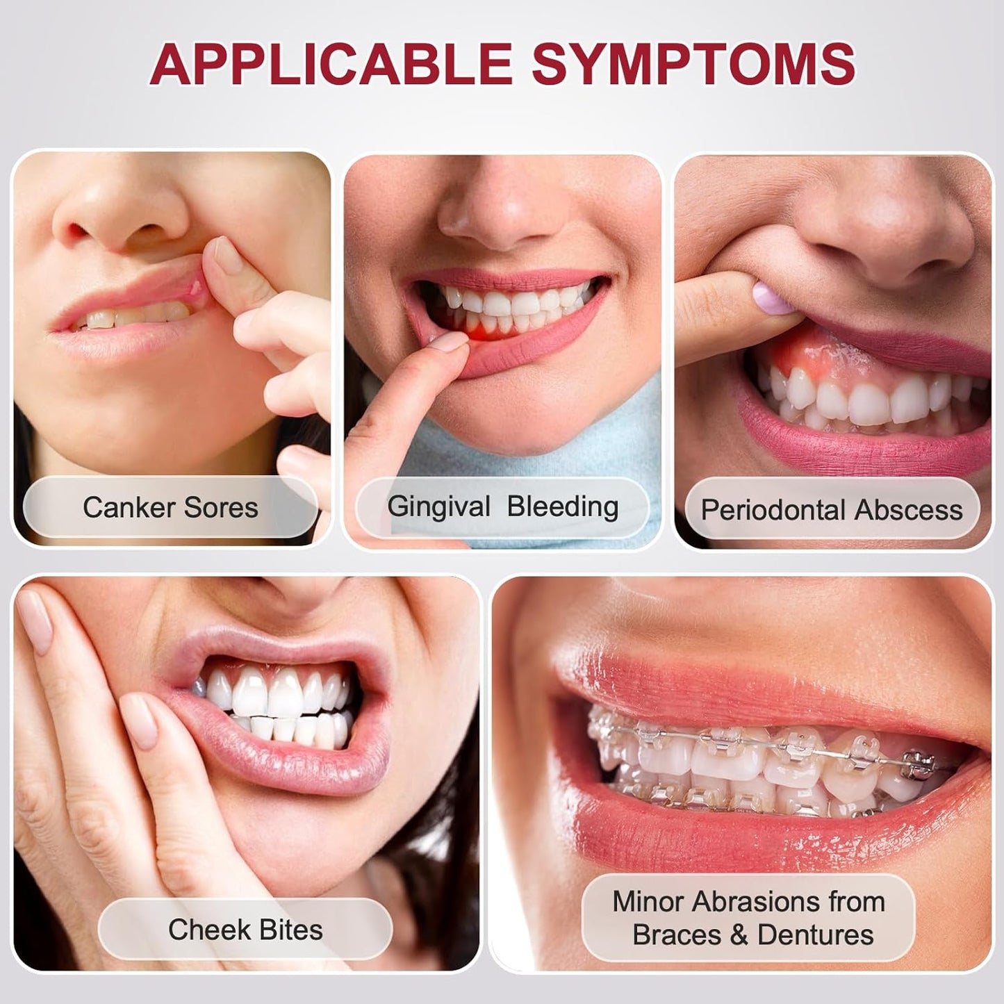 Oral Rinse Mouthwash - Mouth Rinse Help Canker Sores & Gingival Bleeding Treatment - Fresh Mild Mint (100ml/3.4 Fl oz)