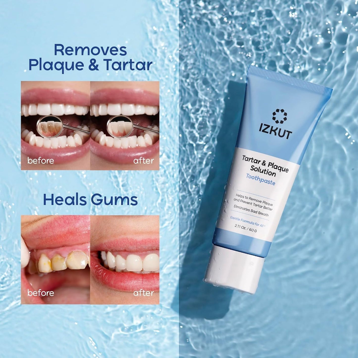 Plaque & Tartar Remover Toothpaste for Teeth: Removes Plaque & Controls Tartar Build-up - Long-Lasting Fresh Breath, Deep Cleansing & Gum-Friendly Formula, Enamel Support Toothpaste for Adults & Kids