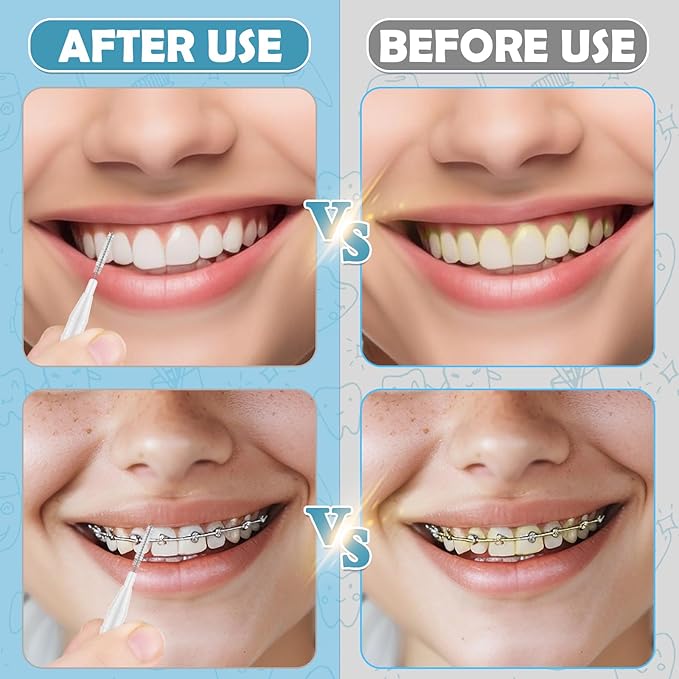 120 Pieces Braces Dental Brush Flosser for Cleaner Interdental Brushes Between Teeth with Soft Bristles 360° Bendable Toothpick Dental Tooth Flossing Oral Dental Hygiene
