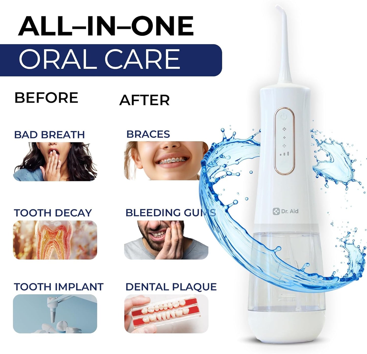 Dr. Aid Dental Water Flosser – Portable Oral Irrigator – 12Oz Tank, Water Filter, 5 Tips, Type C Charger – IPX8 Waterproof Cordless Water Flosser, Ideal Water Flossers for Teeth, Gums, Braces (White)