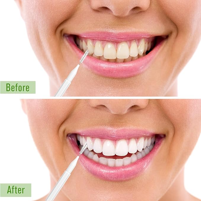 Patelai 100 Pieces Braces Brush for Cleaner Interdental Brush Toothpick Dental Tooth Flossing Head Oral Dental Hygiene Flosser Toothpick Cleaners Tooth Cleaning Tool (White)