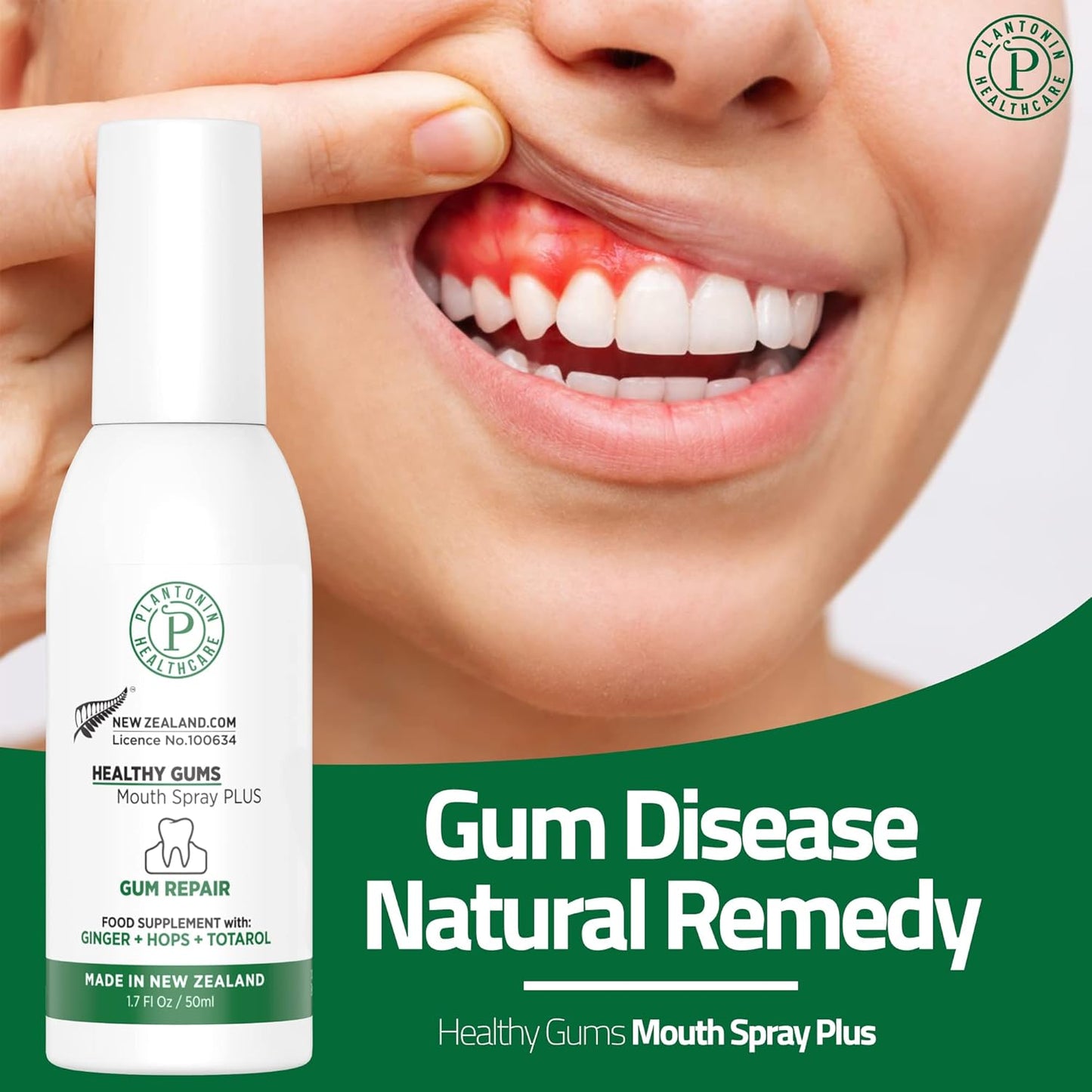 Oral Rinse Spray for Gum Disease and Gingivitis Treatment for Adults - 50ml 142 Servings - Alcohol Free Natural Alternate of Toothpaste with Ginger and Totarol - Bleeding Gums Treatment