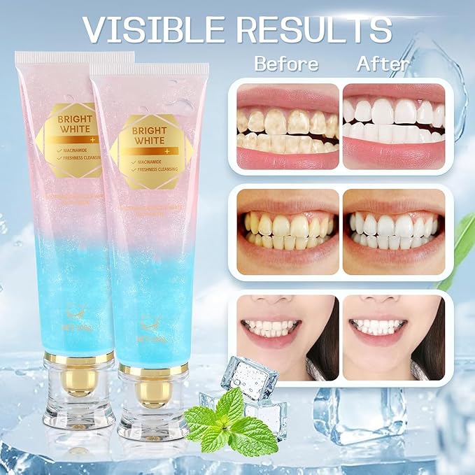 Niacinamide Whitening Toothpaste, Niacinamide Toothpaste with Natural Gentle Care Deep Stain Removal Clean, It Has a Powerful Effect of Whitening Teeth (2PC)