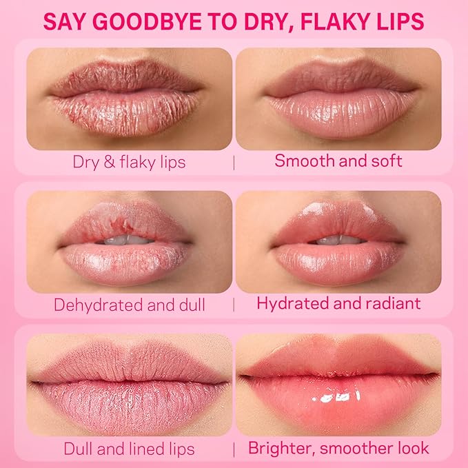 AMOADO Sugar Lip Scrub for Dark Lips – Exfoliating Lip Scrub for Smooth & Soft Lips with Watermelon & Guava, Lip Exfoliator & Moisturizer for Dry, Chapped Lips, Natural Lip Care, 1.2 oz/35g