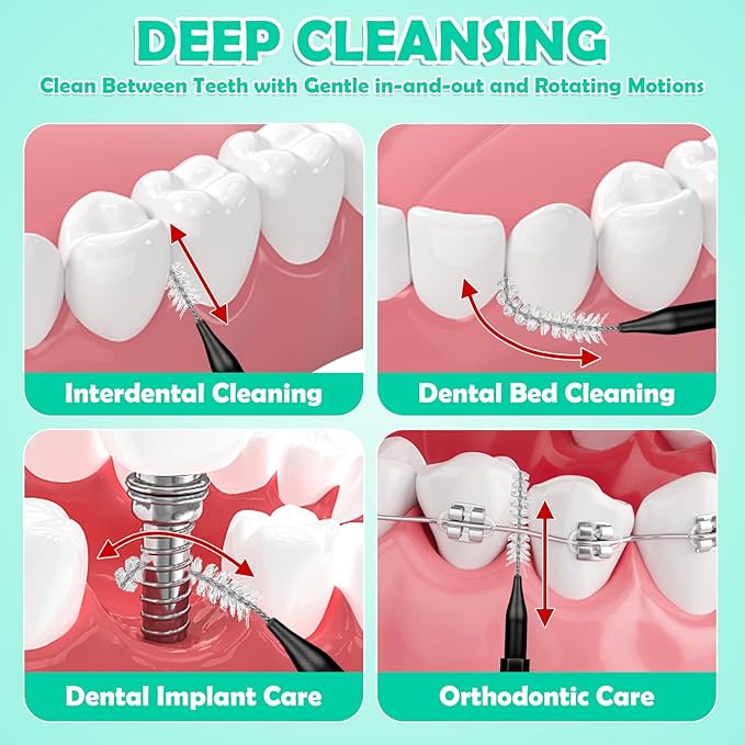 320-Piece Interdental Brush Set, Soft & Flexible Floss Picks for Braces, Orthodontic Care, Teeth Cleaning, 120 Black Spiral Brushes 200 Green Picks, Reusable Oral Care Essentials